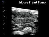Mouse Breast Tumor